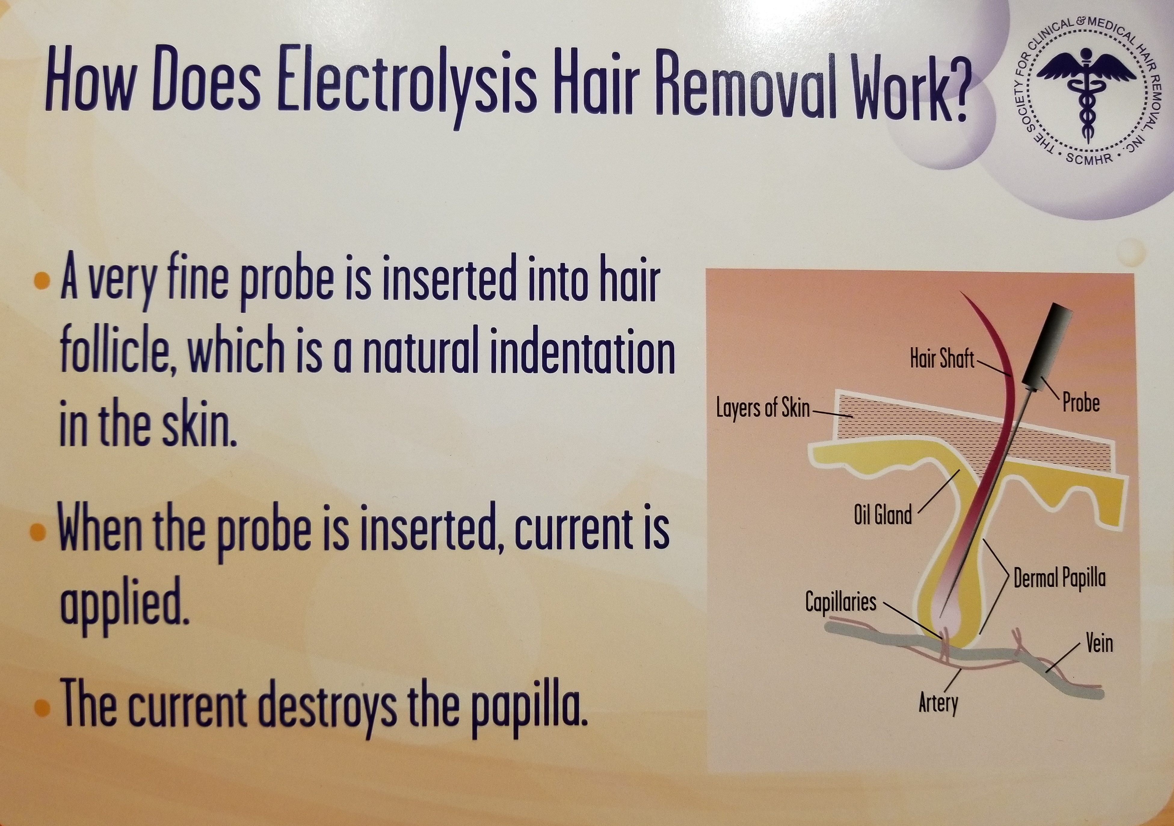 How Does Electrolysis Work?